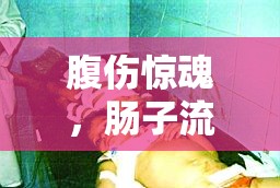腹傷驚魂，腸子流出的瞬間
