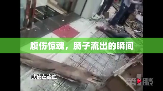 腹傷驚魂，腸子流出的瞬間