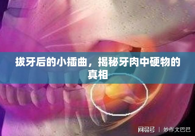 拔牙后的小插曲，揭秘牙肉中硬物的真相
