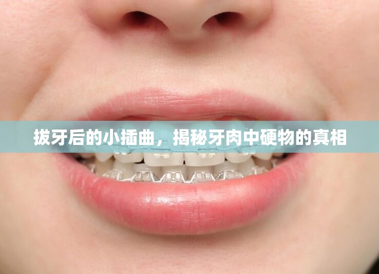 拔牙后的小插曲，揭秘牙肉中硬物的真相