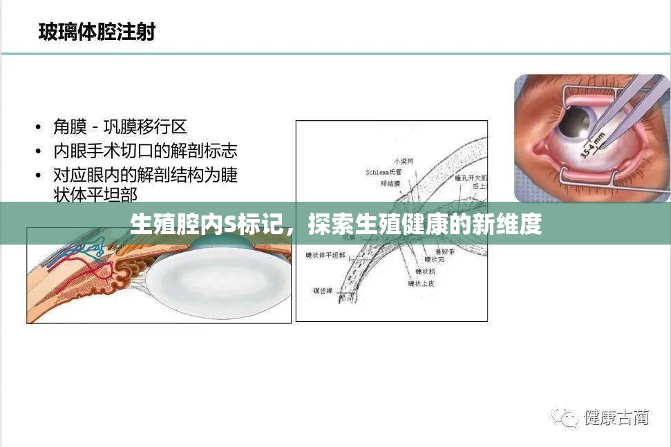 生殖腔內(nèi)S標(biāo)記，探索生殖健康的新維度