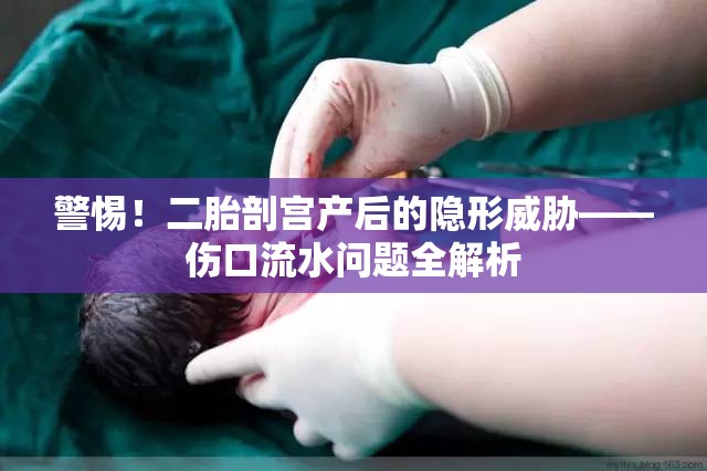 警惕！二胎剖宮產(chǎn)后的隱形威脅——傷口流水問題全解析