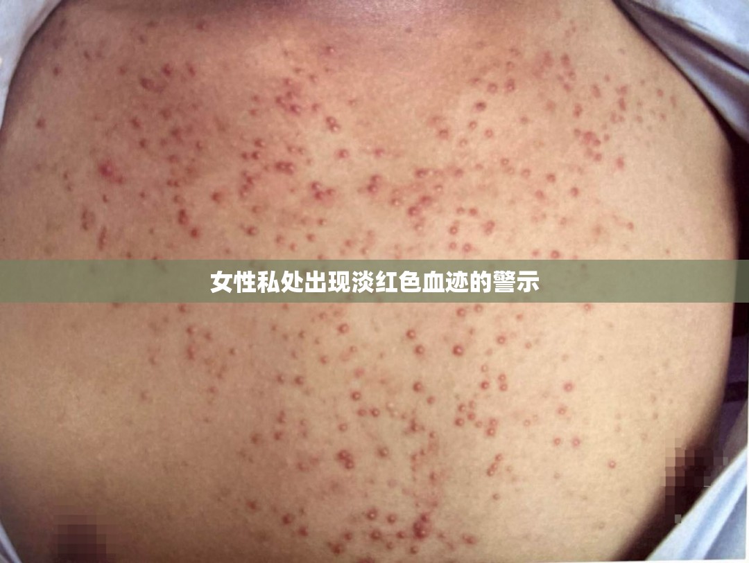 女性私處出現(xiàn)淡紅色血跡的警示