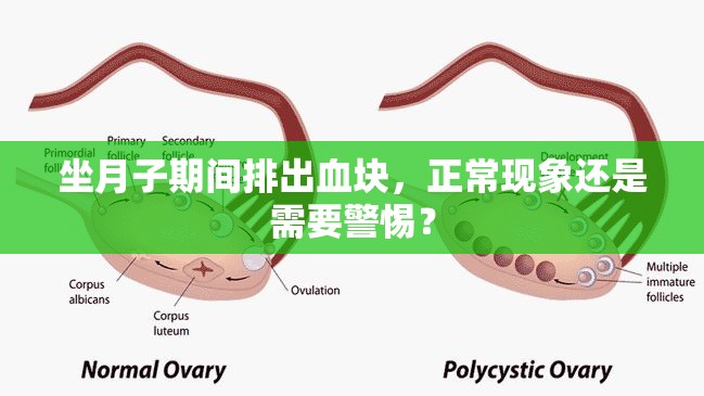 坐月子期間排出血塊，正?，F(xiàn)象還是需要警惕？