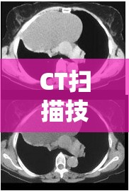 CT掃描技術(shù)揭秘，精準切出右室流出道的技巧與策略