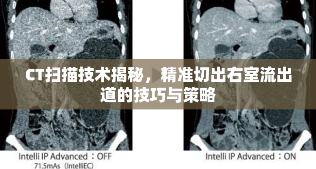 CT掃描技術(shù)揭秘，精準切出右室流出道的技巧與策略