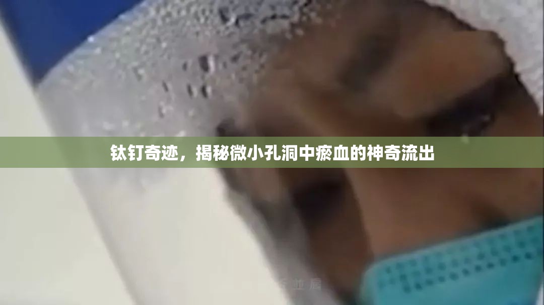 鈦釘奇跡，揭秘微小孔洞中瘀血的神奇流出