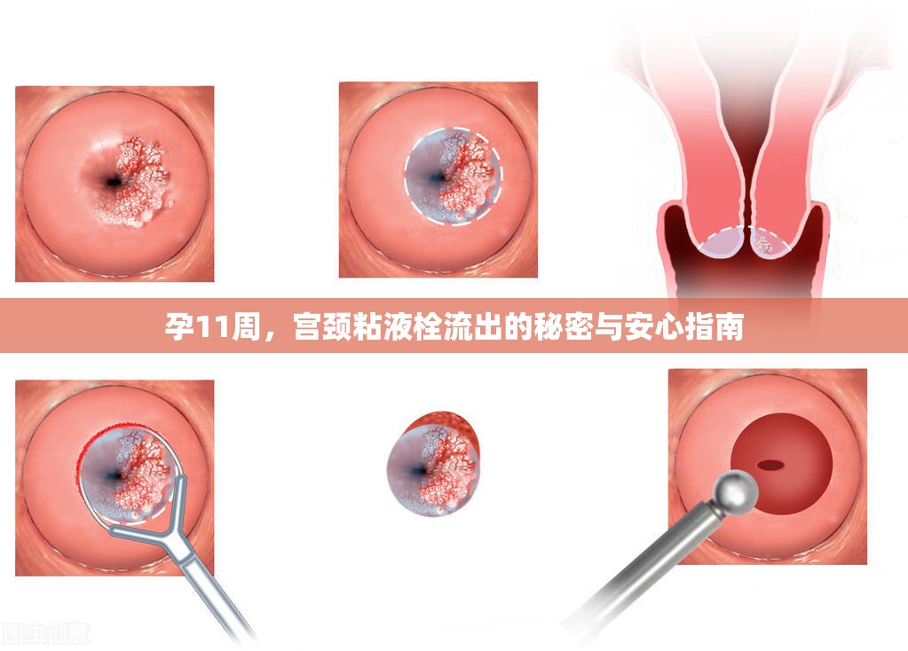 孕11周，宮頸粘液栓流出的秘密與安心指南