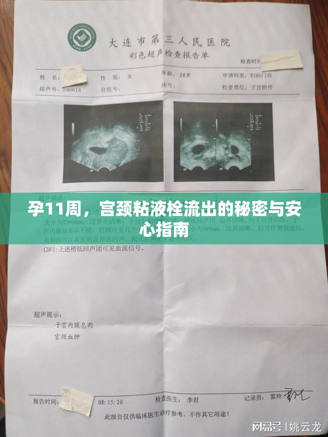 孕11周，宮頸粘液栓流出的秘密與安心指南