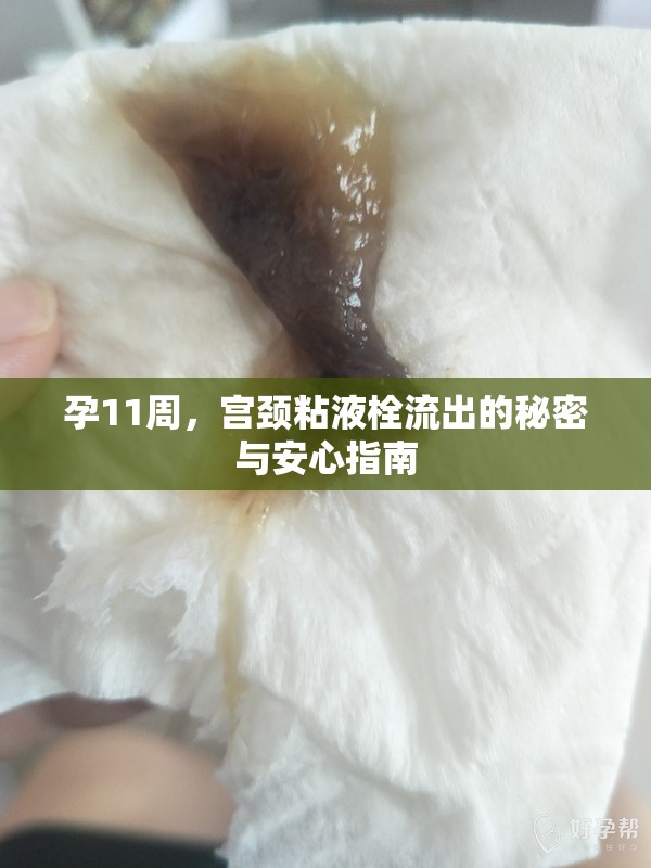 孕11周，宮頸粘液栓流出的秘密與安心指南
