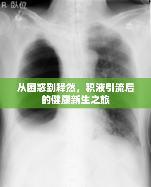 從困惑到釋然，積液引流后的健康新生之旅