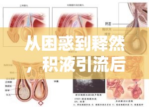 從困惑到釋然，積液引流后的健康新生之旅
