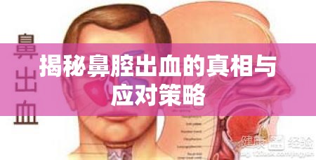 揭秘鼻腔出血的真相與應(yīng)對(duì)策略