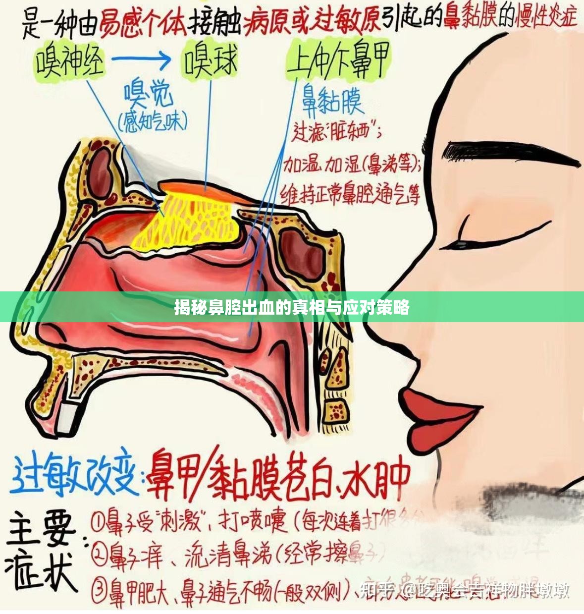 揭秘鼻腔出血的真相與應(yīng)對(duì)策略