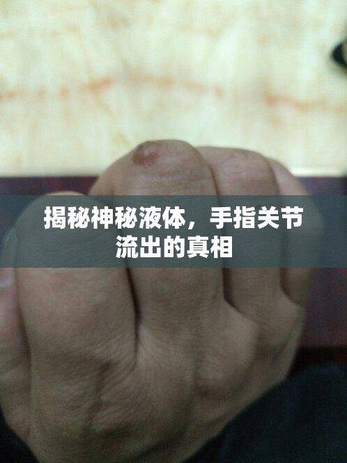 揭秘神秘液體，手指關(guān)節(jié)流出的真相