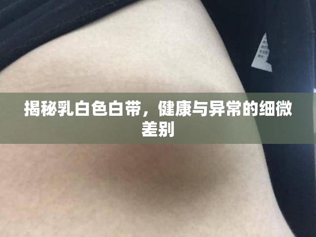 揭秘乳白色白帶，健康與異常的細(xì)微差別