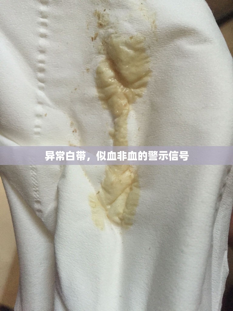 異常白帶，似血非血的警示信號