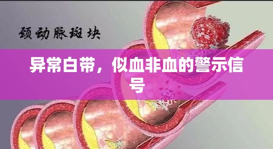 異常白帶，似血非血的警示信號