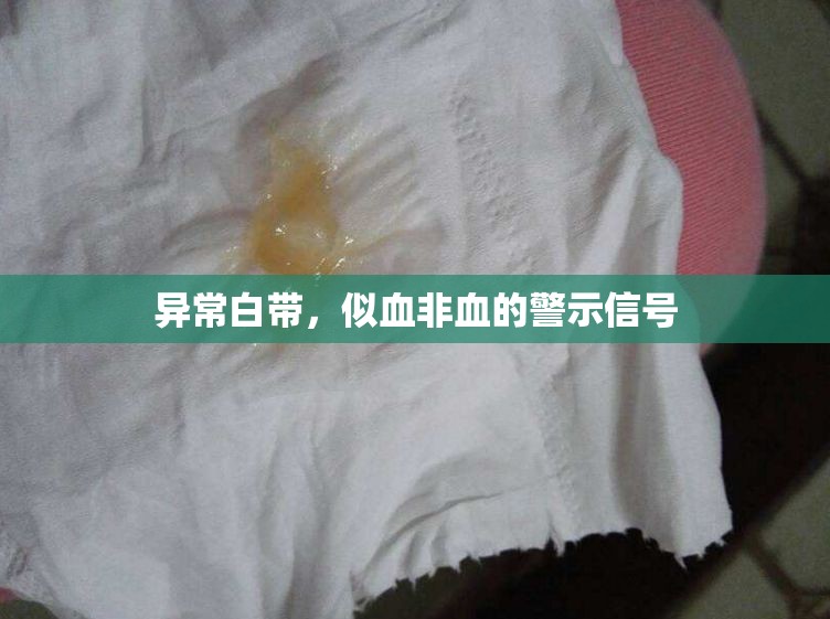 異常白帶，似血非血的警示信號