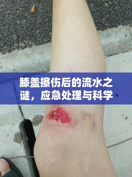 膝蓋擦傷后的流水之謎，應(yīng)急處理與科學(xué)護理全面指南