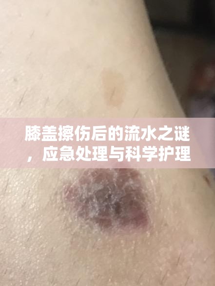 膝蓋擦傷后的流水之謎，應(yīng)急處理與科學(xué)護理全面指南