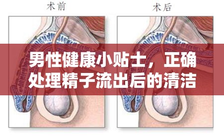 男性健康小貼士，正確處理精子流出后的清潔與護(hù)理