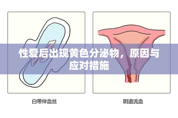 性愛(ài)后出現(xiàn)黃色分泌物，原因與應(yīng)對(duì)措施