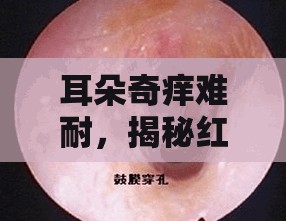耳朵奇癢難耐，揭秘紅色分泌物背后的健康真相