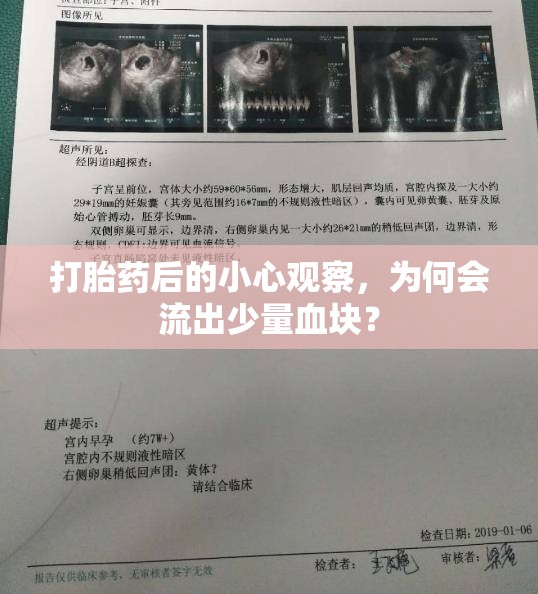 打胎藥后的小心觀察，為何會流出少量血塊？