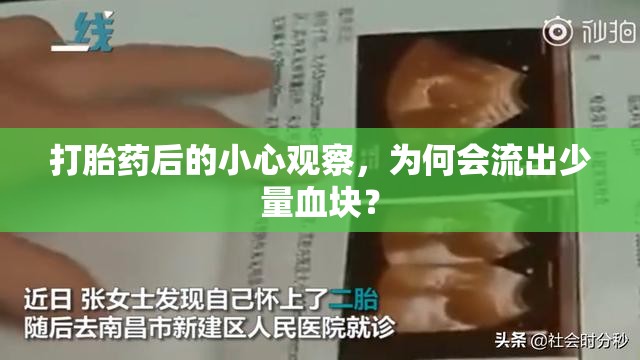 打胎藥后的小心觀察，為何會流出少量血塊？