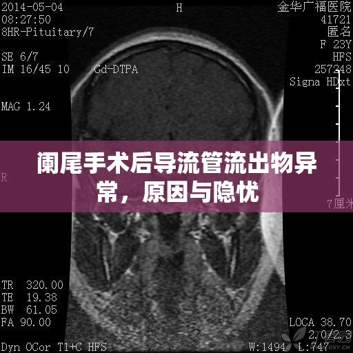 闌尾手術(shù)后導(dǎo)流管流出物異常，原因與隱憂
