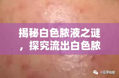揭秘白色膿液之謎，探究流出白色膿液的包背后的真相