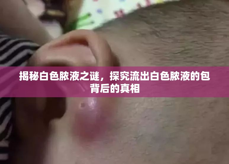 揭秘白色膿液之謎，探究流出白色膿液的包背后的真相