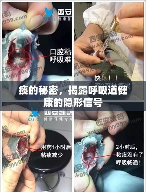 痰的秘密，揭露呼吸道健康的隱形信號