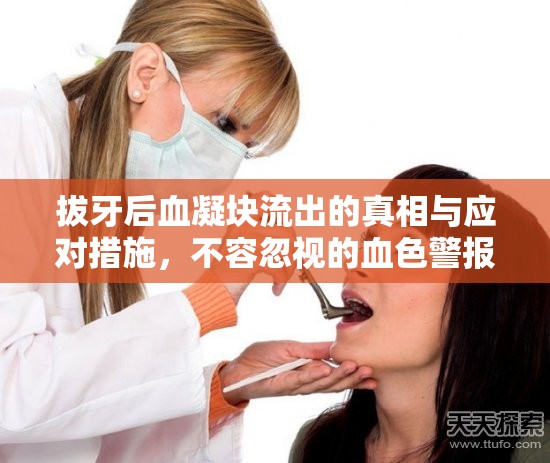 拔牙后血凝塊流出的真相與應(yīng)對(duì)措施，不容忽視的血色警報(bào)