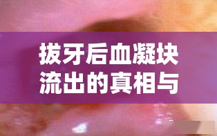 拔牙后血凝塊流出的真相與應(yīng)對(duì)措施，不容忽視的血色警報(bào)