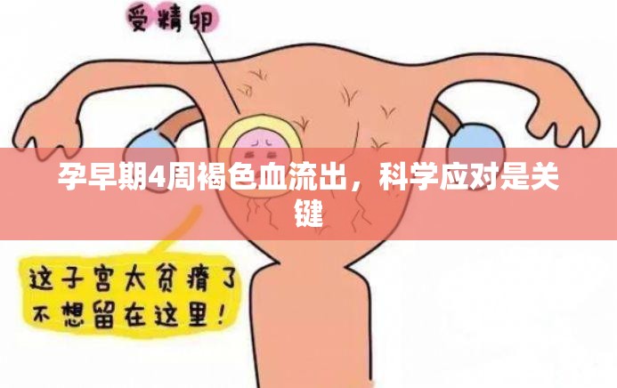 孕早期4周褐色血流出，科學(xué)應(yīng)對是關(guān)鍵