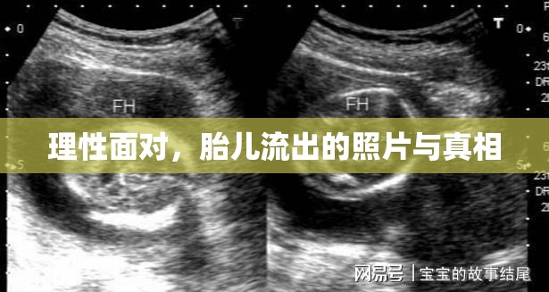 理性面對(duì)，胎兒流出的照片與真相
