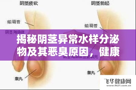 揭秘陰莖異常水樣分泌物及其惡臭原因，健康警報(bào)與應(yīng)對(duì)策略