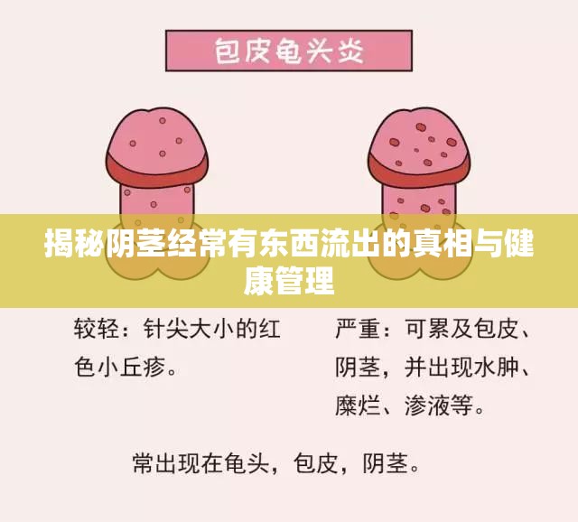揭秘陰莖經常有東西流出的真相與健康管理