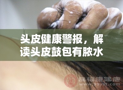 頭皮健康警報(bào)，解讀頭皮鼓包有膿水流出的背后真相