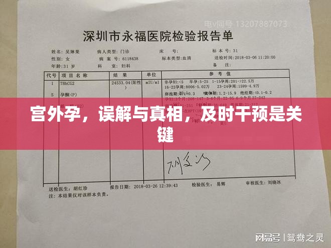 宮外孕，誤解與真相，及時干預(yù)是關(guān)鍵
