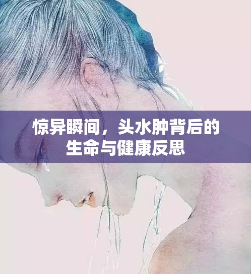 驚異瞬間，頭水腫背后的生命與健康反思