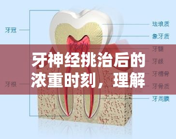 牙神經(jīng)挑治后的濃重時刻，理解與應(yīng)對策略