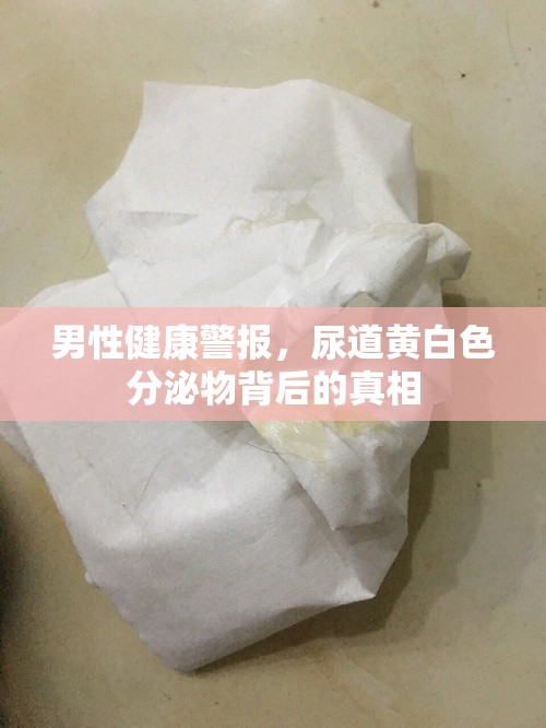 男性健康警報，尿道黃白色分泌物背后的真相