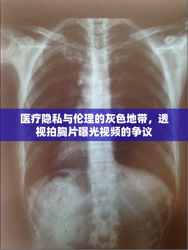 醫(yī)療隱私與倫理的灰色地帶，透視拍胸片曝光視頻的爭議