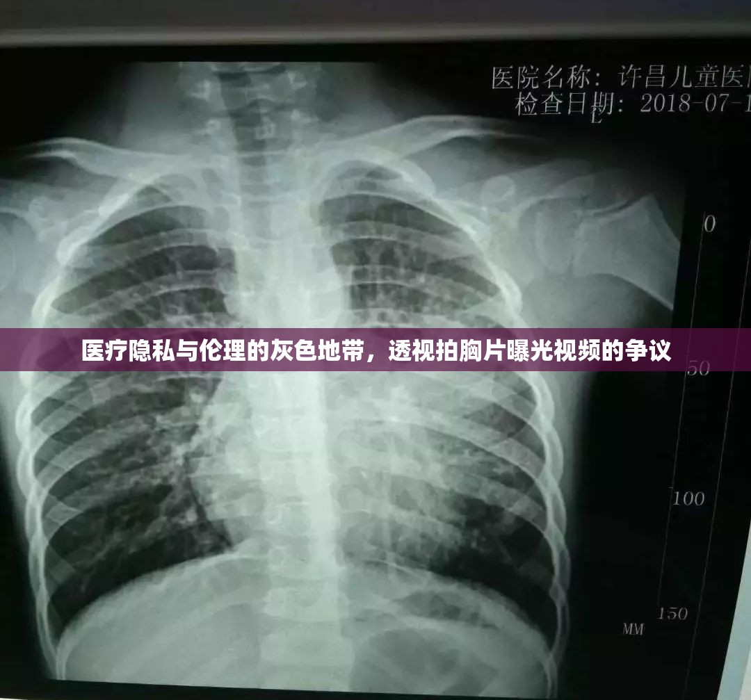 醫(yī)療隱私與倫理的灰色地帶，透視拍胸片曝光視頻的爭議