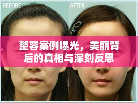 整容案例曝光，美麗背后的真相與深刻反思