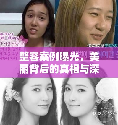 整容案例曝光，美麗背后的真相與深刻反思