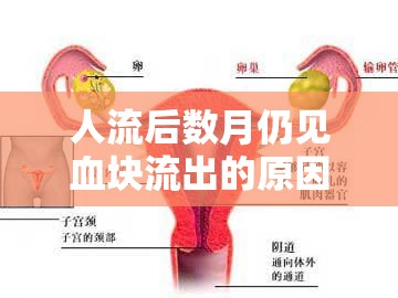 人流后數月仍見血塊流出的原因、風險及應對策略